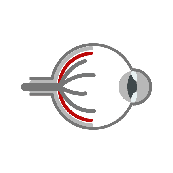 distacco della retina