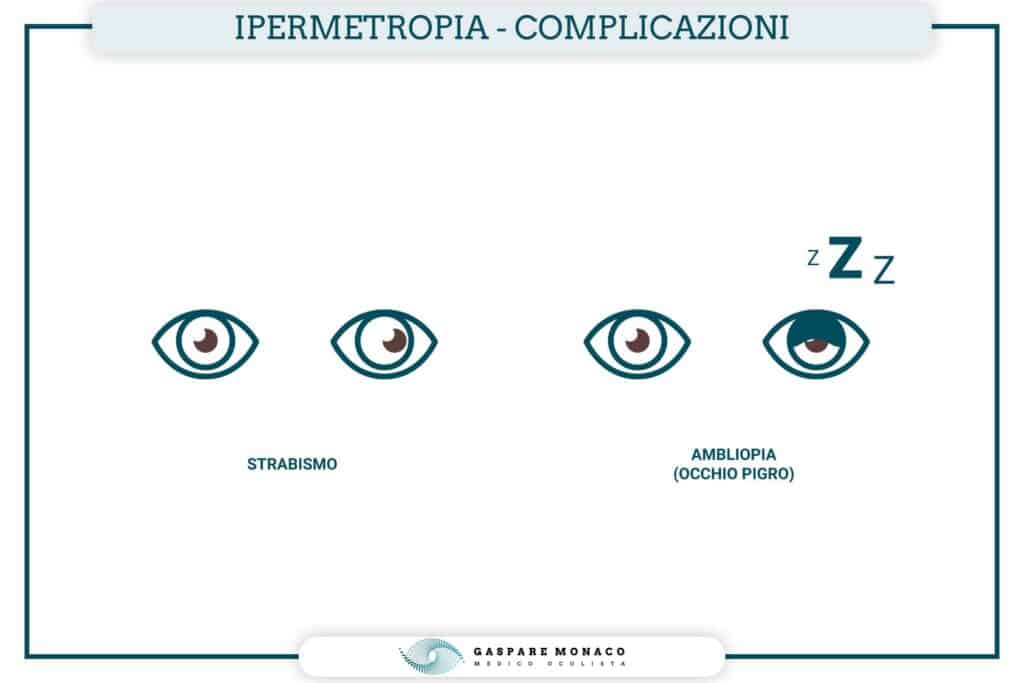 ipermetropia nei bambini