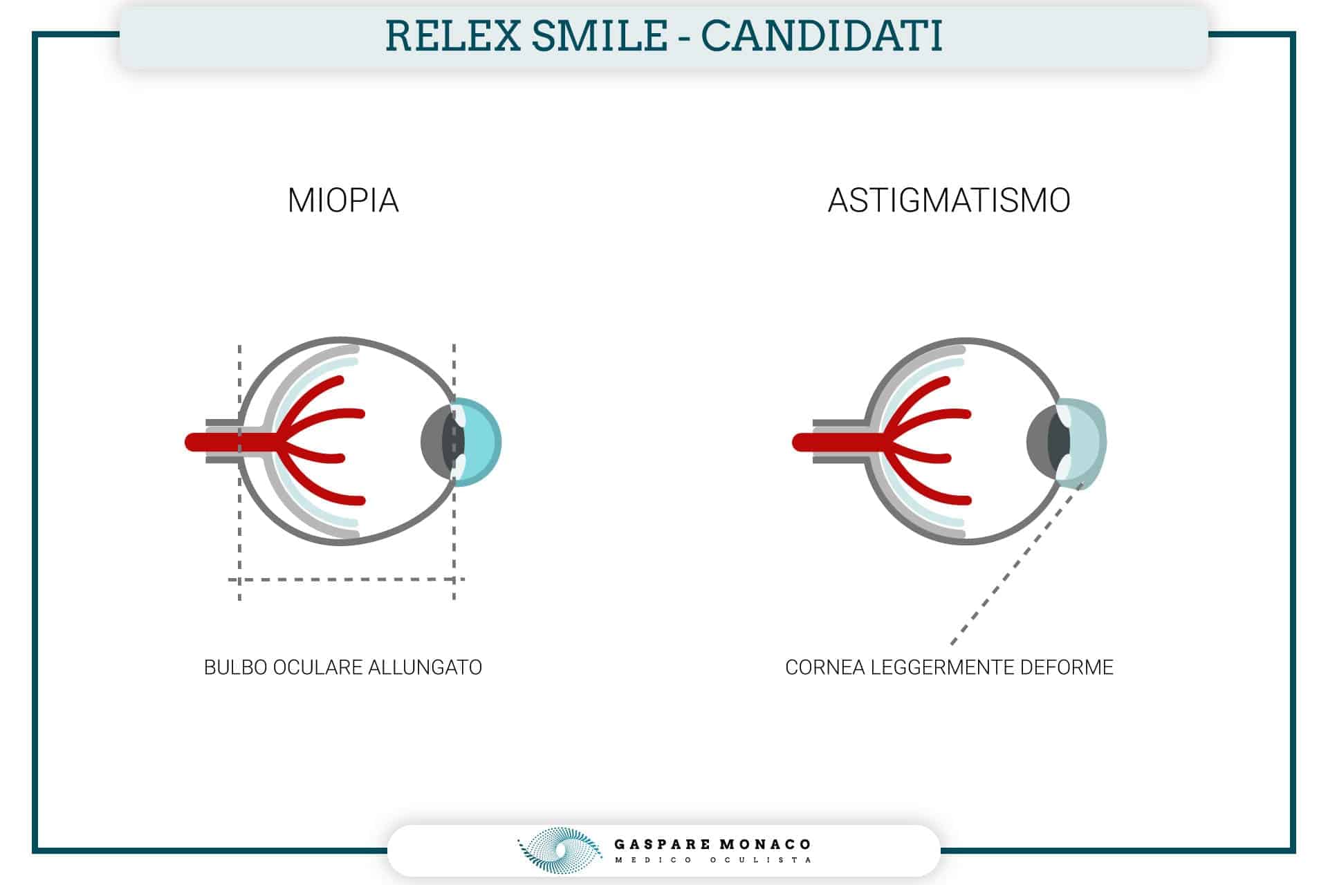 Relex smile clinicaspectr ru. Релекс Смайл. Lasic smile лазер. Протокол работы лазера smile. Смайл лазер когда появился метод.